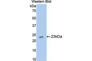 Western blot analysis of the recombinant protein. (COMP anticorps  (AA 235-423))