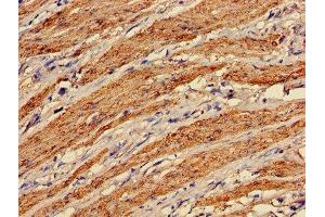 Immunohistochemistry of paraffin-embedded human smooth muscle tissue using ABIN7172847 at dilution of 1:100 (Transgelin anticorps  (AA 2-201))