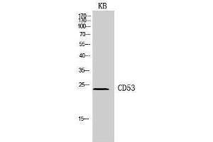 Western Blotting (WB) image for anti-CD53 (CD53) (Internal Region) antibody (ABIN3181436)