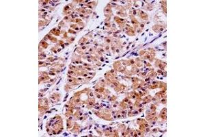 Immunohistochemistry analysis in formalin fixed and paraffin embedded human stomach tissue reacted with KLK15 / Kallikrein-15 Antibody (Center) followed by peroxidase conjugation of the secondary antibody and DAB staining. (Kallikrein 15 anticorps  (Middle Region))