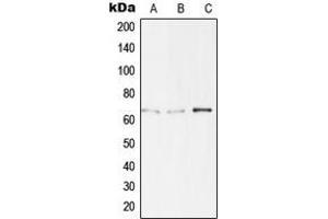 Western blot analysis of TBX15/18 expression in Jurkat (A), HepG2 (B), LOVO (C) whole cell lysates. (T-Box 15/18 anticorps  (Center))