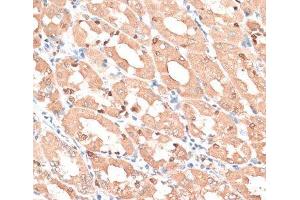 Immunohistochemistry of paraffin-embedded Human stomach using HMGA1 Polyclonal Antibody at dilution of 1:100 (40x lens). (HMGA1 anticorps)