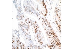 Immunohistochemistry (IHC) image for anti-Proliferating Cell Nuclear Antigen (PCNA) antibody (ABIN7453982)