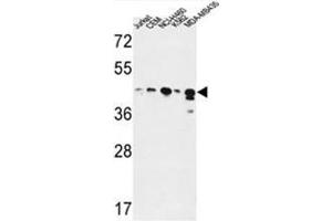 ADH7 Antibody (C-Term) western blot analysis in Jurkat,CEM,NCI-H460,K562,MDA-MB435 cell line lysates (35µg/lane). (ADH7 anticorps  (C-Term))