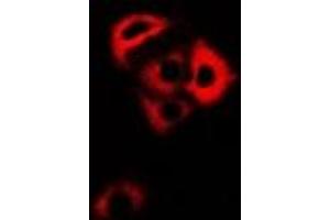 Immunofluorescent analysis of ARFGAP1 staining in HepG2 cells. (ARFGAP1 anticorps)