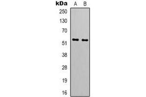 Western blot analysis of GIP Receptor expression in HT1080 (A), A549 (B) whole cell lysates. (GIPR anticorps)
