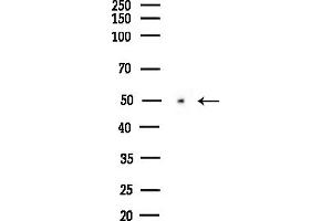 anti-Dihydropyrimidinase-Like 4 (DPYSL4) (Internal Region) antibody