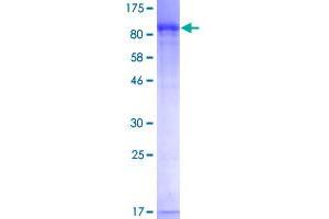 Image no. 1 for Guanine Monophosphate Synthetase (GMPS) (AA 1-693) protein (GST tag) (ABIN1355322)