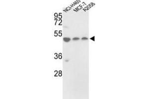 Western Blotting (WB) image for anti-Protein Disulfide Isomerase Family A, Member 6 (PDIA6) antibody (ABIN3002738) (PDIA6 anticorps)