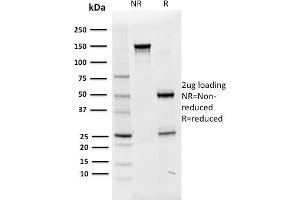 SDS-PAGE Analysis Purified Oct-2 Mouse Monoclonal Antibody (OCT2/2136).