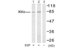 Western blot analysis of extracts from 293 cells (Lane 1) and MDA-MB-435 cells (Lane 2 and 3), untreated or treated with EGF, using IKKα (Ab-23) antibody (E021123). (IKK alpha anticorps)