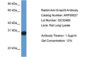 Western Blotting (WB) image for anti-Synaptosomal-Associated Protein, 29kDa (SNAP29) (Middle Region) antibody (ABIN2788104) (SNAP29 anticorps  (Middle Region))