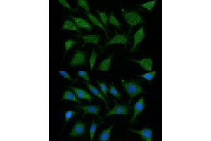Immunofluorescence analysis of L929 using TRIM45 antibody (ABIN6132737, ABIN6149529, ABIN6149530 and ABIN6216483) at dilution of 1:100 (40x lens). (TRIM45 anticorps  (AA 100-400))