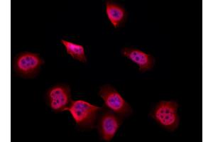 ABIN6265102 and ABIN6277278 staining Hela by IF/ICC.
