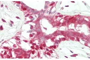 Formalin-fixed and paraffin-embedded H.