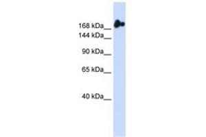Image no. 1 for anti-Nucleoporin 98kDa (NUP98) (AA 36-85) antibody (ABIN6742838) (NUP98 anticorps  (AA 36-85))