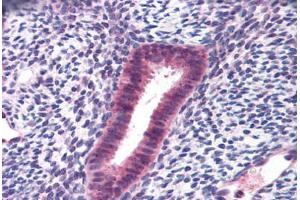 Human Uterus: Formalin-Fixed, Paraffin-Embedded (FFPE) (FOXN1 anticorps  (AA 585-648))