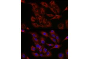 Immunofluorescence analysis of A-549 cells using Bcl-2 antibody (ABIN7265813) at dilution of 1:250. (Bcl-2 anticorps  (AA 1-100))