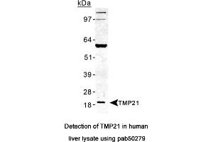 Image no. 2 for anti-Transmembrane Emp24-Like Trafficking Protein 10 (TMED10) (AA 100-200) antibody (ABIN363588) (TMED10 anticorps  (AA 100-200))