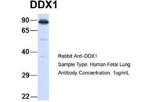 Host:  Rabbit  Target Name:  DDX1  Sample Type:  Human Fetal Lung  Antibody Dilution:  1. (DDX1 anticorps  (Middle Region))