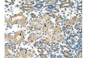 Image no. 1 for anti-Doublesex and Mab-3 Related Transcription Factor 2 (DMRT2) (N-Term) antibody (ABIN203207)