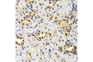 Immunohistochemistry of paraffin-embedded rat kidney using DNMT3A antibody at dilution of 1:200 (400x lens). (DNMT3A anticorps)