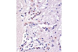 A staining YY1 in Zebra fish brain tissue sections by Immunohistochemistry (IHC-P - paraformaldehyde-fixed, paraffin-embedded sections).