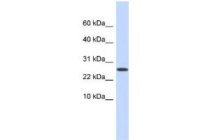 WB Suggested Anti-PDPN Antibody Titration: 0. (Podoplanin anticorps  (Middle Region))