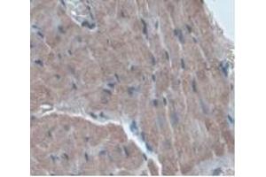Detection of a1AGP in Rat Heart Tissue using Monoclonal Antibody to Alpha-1-Acid Glycoprotein (a1AGP)