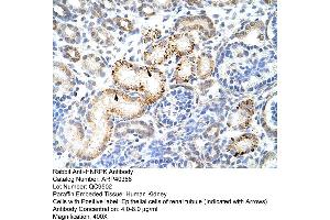 Rabbit Anti-HNRPK Antibody  Paraffin Embedded Tissue: Human Kidney Cellular Data: Epithelial cells of renal tubule Antibody Concentration: 4. (HNRNPK anticorps  (N-Term))