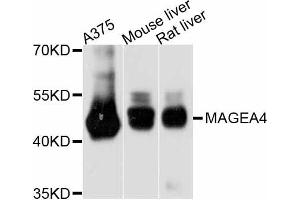 Western blot analysis of extracts of various cell lines, using MAGEA4 antibody. (MAGEA4 anticorps)