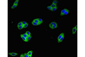 Immunofluorescent analysis of HepG2 cells using ABIN7154617 at dilution of 1:100 and Alexa Fluor 488-congugated AffiniPure Goat Anti-Rabbit IgG(H+L)