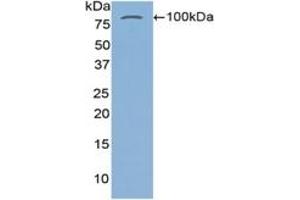 WB of Protein Standard: different control antibodies against Highly purified E.