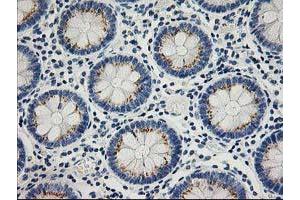 Immunohistochemistry (IHC) image for anti-Protein tyrosine Phosphatase, Non-Receptor Type 1 (PTPN1) antibody (ABIN1500496)