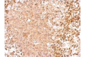 IHC-P Image GAD65 antibody [C2C3], C-term detects GAD2 protein at cytosol on RT2 xenograft by immunohistochemical analysis. (GAD65 anticorps  (C-Term))