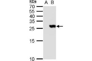 WB Image TMS1 antibody detects TMS1 protein by western blot analysis. (PYCARD anticorps)