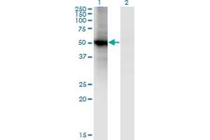 Western Blot analysis of RORB expression in transfected 293T cell line by RORB monoclonal antibody (M01), clone 4B4. (RORB anticorps  (AA 136-224))