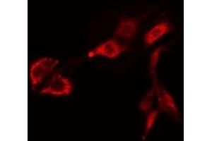 ABIN6275468 staining Hela cells by IF/ICC. (RAB38 anticorps  (Internal Region))