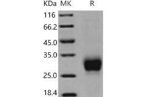 Western Blotting (WB) image for Fc Fragment of IgG, Low Affinity IIIa, Receptor (CD16a) (FCGR3A) (Active) protein (His tag) (ABIN7195703)