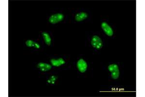Immunofluorescence of purified MaxPab antibody to EXOSC7 on HeLa cell.