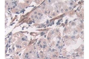 Detection of TAGLN in Human Stomach Tissue using Polyclonal Antibody to Transgelin (TAGLN)