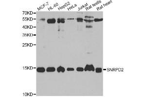 Western blot analysis of extracts of various cell lines, using SNRPD2 antibody (ABIN2560047) at 1:1000 dilution. (SNRPD2 anticorps)