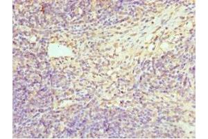 Immunohistochemistry of paraffin-embedded human thymus tissue using ABIN7155076 at dilution of 1:100 (HPS1 anticorps  (AA 1-324))