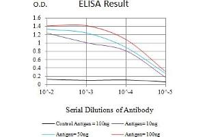 Black line: Control Antigen (100 ng),Purple line: Antigen (10 ng), Blue line: Antigen (50 ng), Red line:Antigen (100 ng)