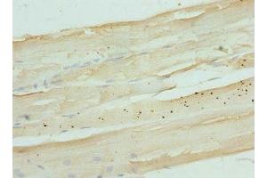 Immunohistochemistry of paraffin-embedded human skeletal muscle tissue using ABIN7165854 at dilution of 1:100