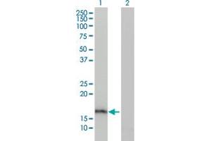 Western Blot analysis of AGR2 expression in transfected 293T cell line by AGR2 monoclonal antibody (M03), clone 1C3. (AGR2 anticorps  (AA 1-175))