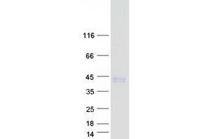 Validation with Western Blot