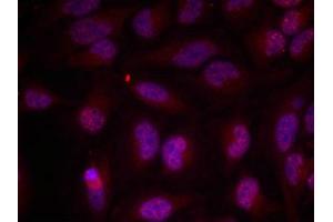 Immunofluorescence staining of methanol-fixed Hela cells using Myc(Phospho-Thr358) Antibody. (c-MYC anticorps  (pThr358))