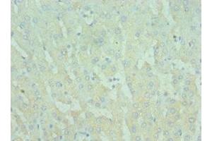 Immunohistochemistry of paraffin-embedded human liver tissue using ABIN7172290 at dilution of 1:100