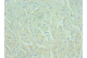 Immunohistochemistry of paraffin-embedded human liver tissue using ABIN7172290 at dilution of 1:100 (TIRAP anticorps  (AA 1-221))